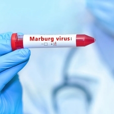 الإمارات العربية المتحدة تحذر مواطنيها من فيروس "ماربورغ"