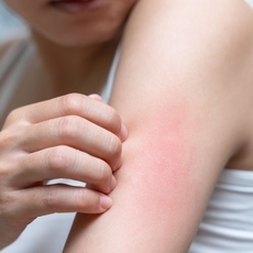 ما هي اسباب حساسية الجلد المفاجئة؟