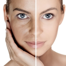 علاج التصبغات الجلدية العميقة لتقولي وداعاً لها!