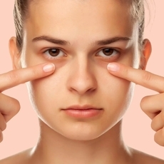 هل السواد تحت العين خطير؟