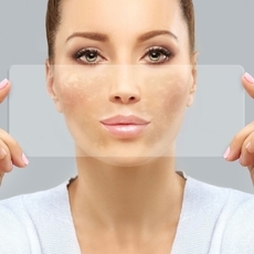 تصبغات حول الفم: كيف تستعيدين إشراق بشرتك؟