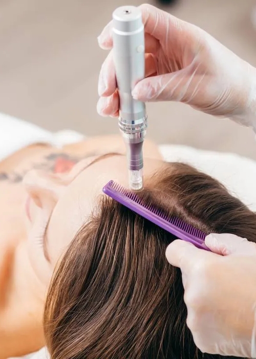 اضرار حقن البلازما للشعر عديدة اكتشفيها!