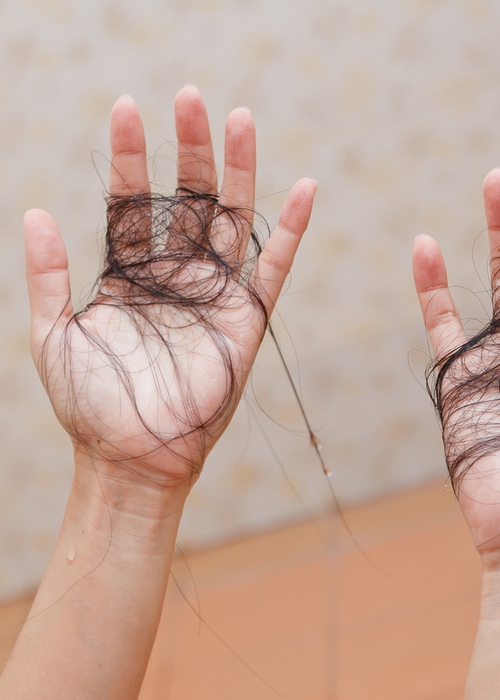 ما هو تفسير حلم تساقط الشعر والبكاء عليه؟