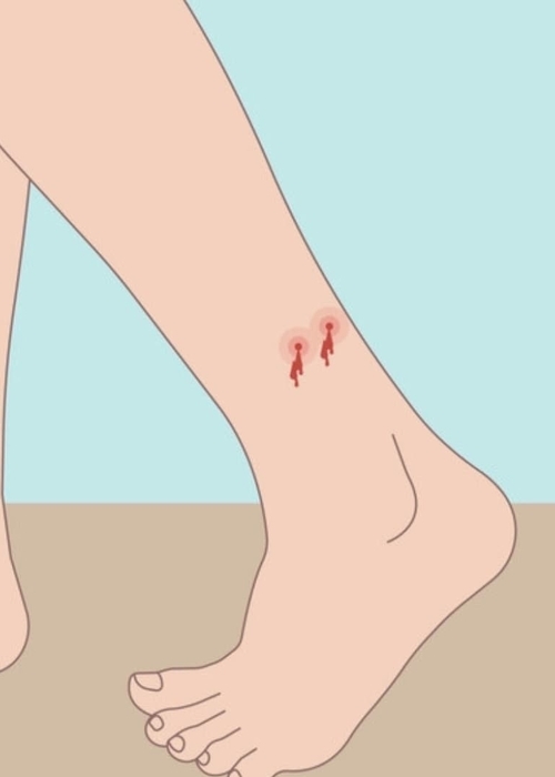 تفسير حلم لدغة الثعبان في القدم اليسرى