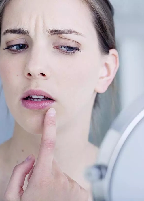 حبوب صغيرة في الوجه: متى تحتاجين زيارة الطبيب؟
