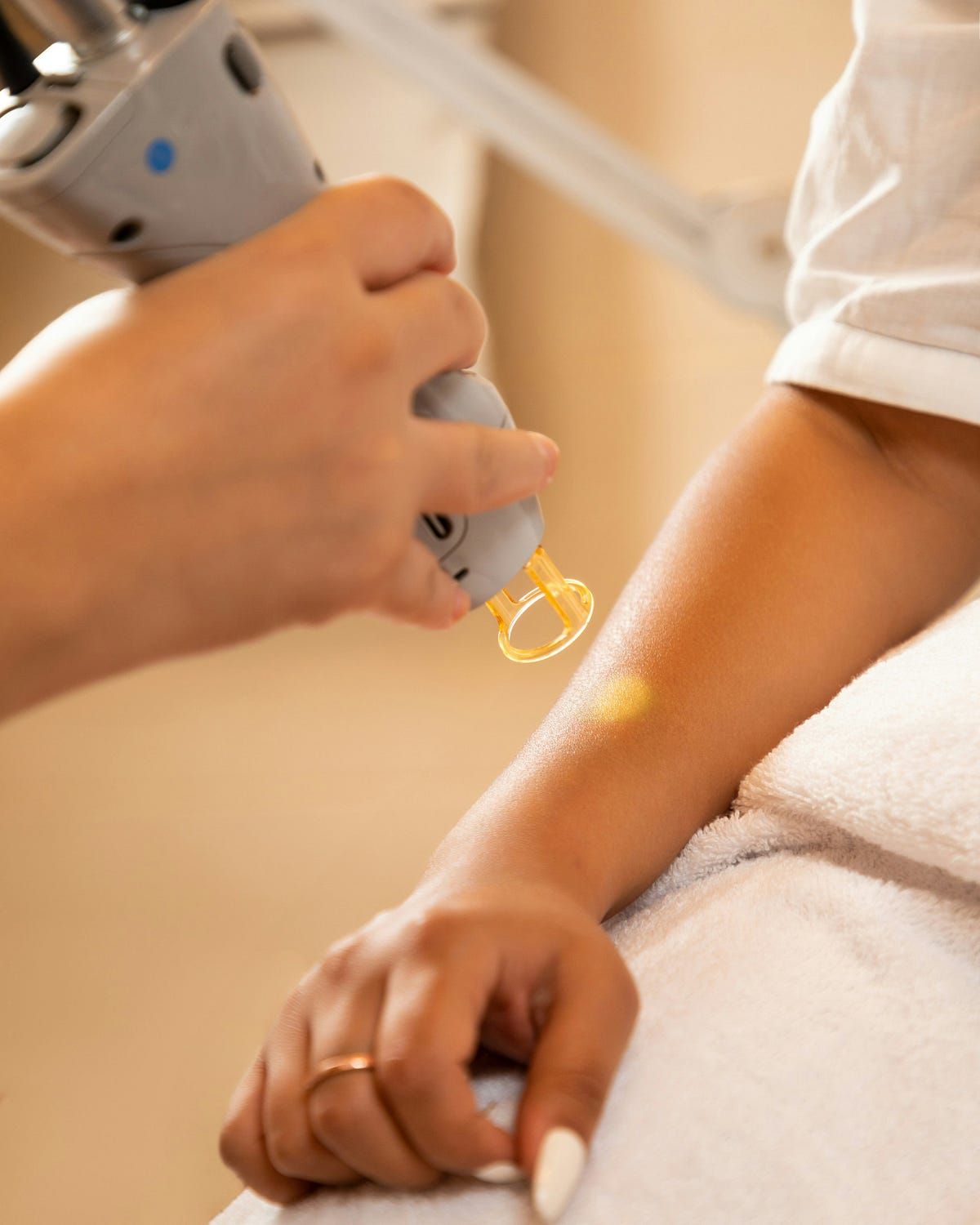 ما أسباب ظهور التصبغات بعد بعض إجراءات إزالة الشعر؟